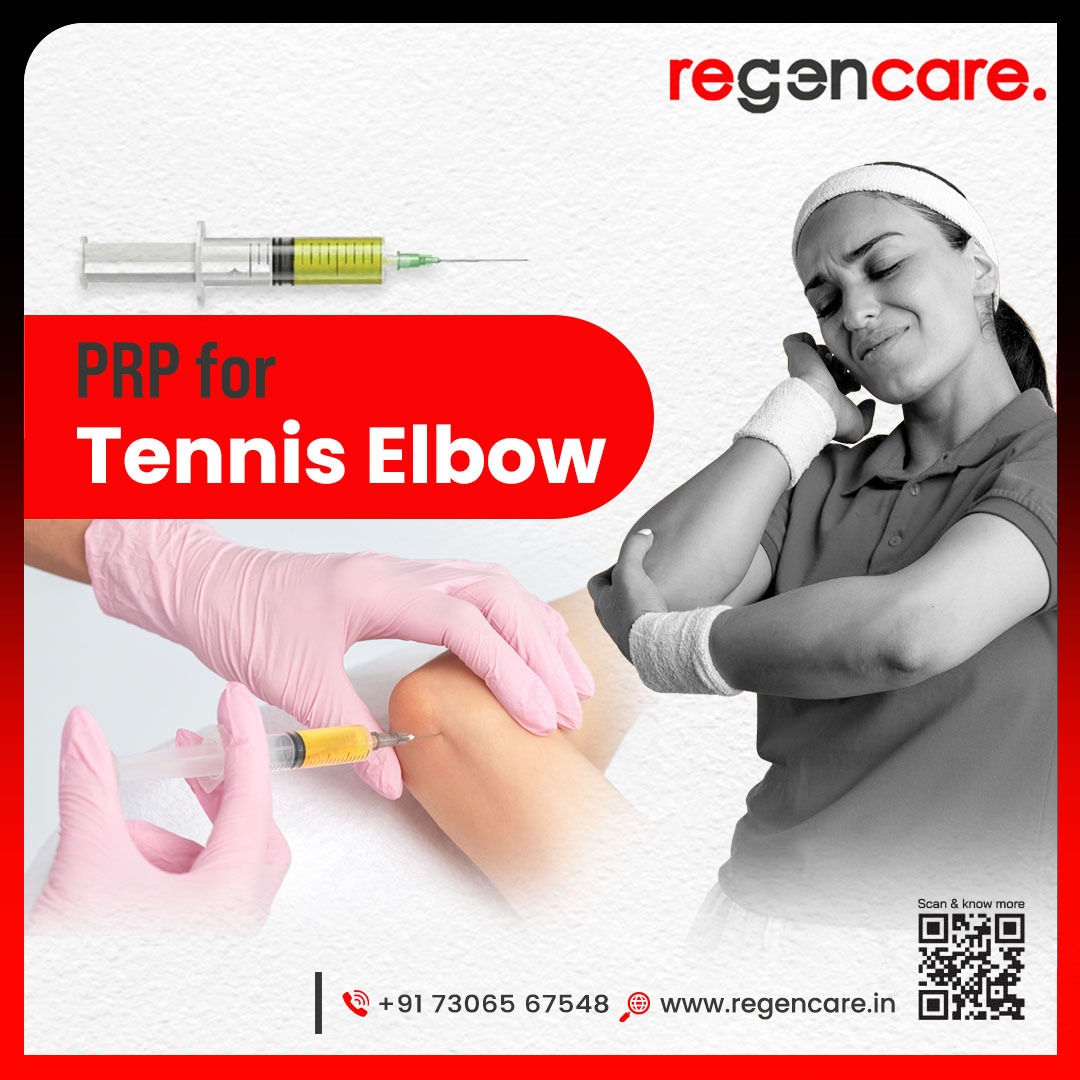 PRP treatment for tennis elbow in Kochi - Regencare